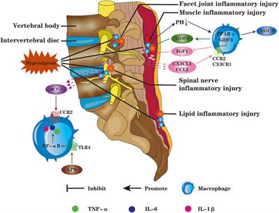 New Progress in Basic Research of Macrophages in the Pathogenesis and Treatment of Low Back Pain